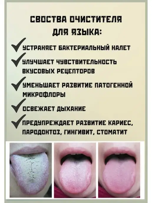 MaGazия Скребок Массажер для чистки языка, желтый, фото 4