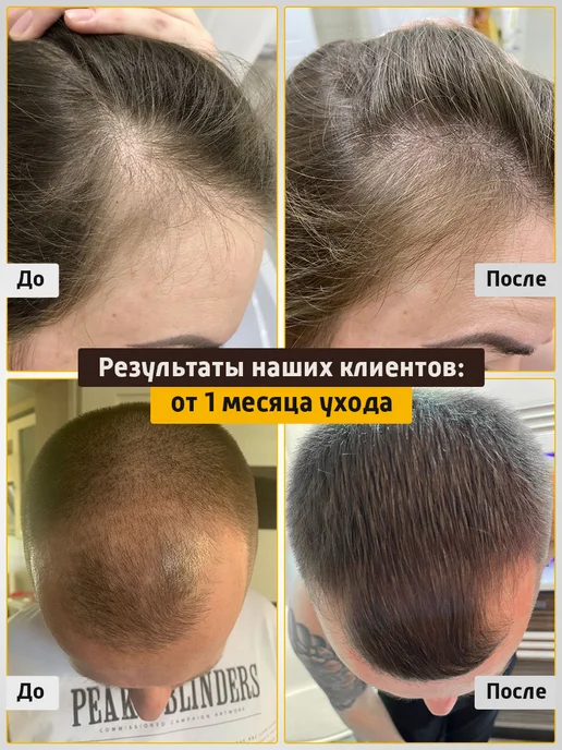 Dari cosmetics Средства для роста волос 3шт, 3 шт, фото 2