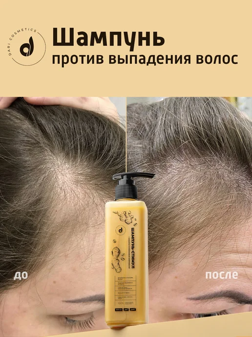 Dari cosmetics Средства для роста волос 3шт, 3 шт, фото 5