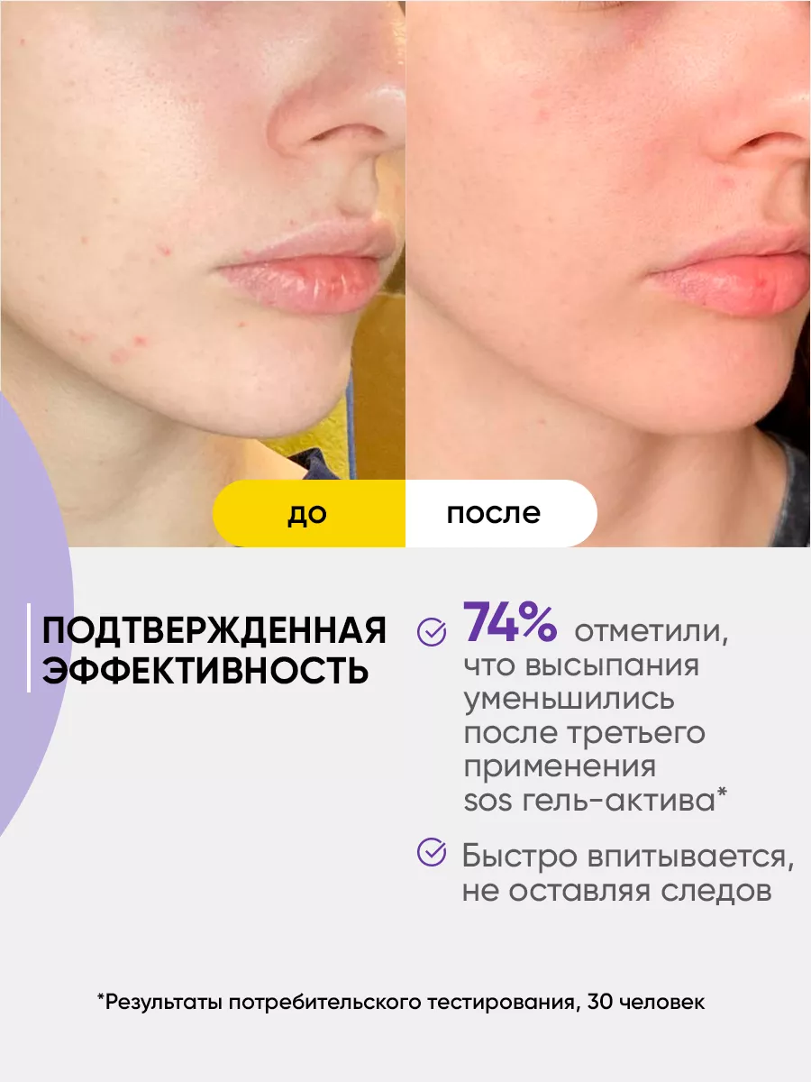 Гель для лица от прыщей для подростков, крем уход, 20 мл. DR. ESTHETICA  116366774 купить за 300 ₽ в интернет-магазине Wildberries